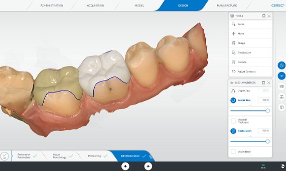 CEREC software image